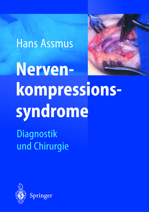 Nerven-kompressions-syndrome