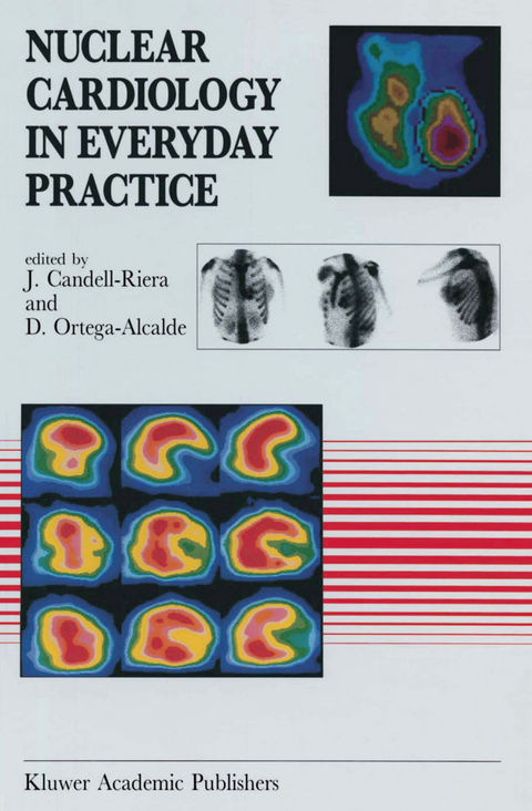 Nuclear Cardiology in Everyday Practice - 