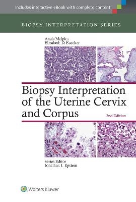 Biopsy Interpretation of the Uterine Cervix and Corpus - 