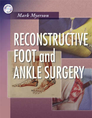 Reconstructive Foot and Ankle Surgery - Mark S. Myerson