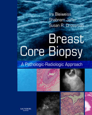 Breast Core Biopsy - Shabnam Jaffer, Susan R. Drossman, Ira Bleiweiss