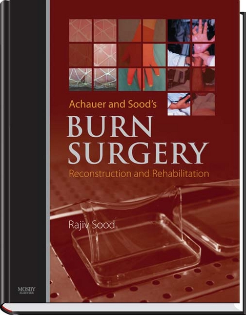 Achauer and Sood's Burn Surgery, Reconstruction and Rehabilitation - Rajiv Sood