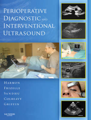 Perioperative Diagnostic and Interventional Ultrasound with DVD - Dominic Harmon, Henry P. Frizelle, Navparkash S. Sandhu, Frances Colreavy, Michael Griffin