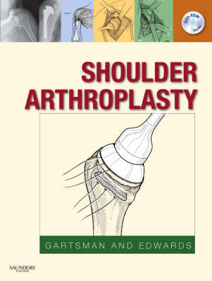 Shoulder Arthroplasty - Gary M. Gartsman, T. Bradley Edwards