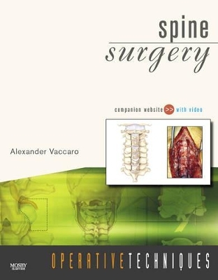 Spine Surgery - 