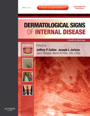 Dermatological Signs of Internal Disease - Jeffrey P. Callen, Joseph L. Jorizzo, Jean L. Bolognia, John J. Zone, Warren Piette