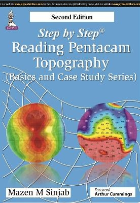 Step by Step: Reading Pentacam Topography - Mazen M Sinjab