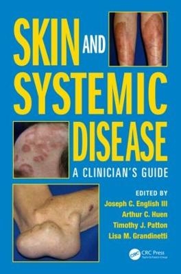 Skin and Systemic Disease - Joseph C. English III, Arthur C. Huen, Timothy J. Patton, Lisa M. Grandinetti