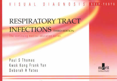 Visual Diagnosis Self-Tests in Respiratory Tract Infection - P. Thomas