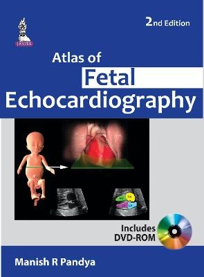 Atlas of Fetal Echocardiography - Manish R Pandya