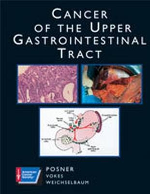 Cancer of the Upper Gastrointestinal Tract - 