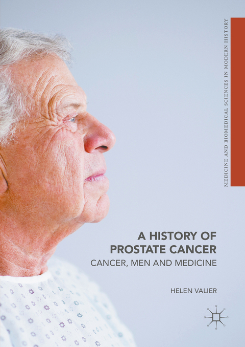 A History of Prostate Cancer - Helen Valier