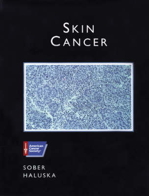 Skin Cancer - Arthur J. Sober, Frank G. Haluska