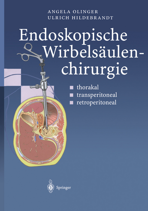 Endoskopische Wirbelsäulenchirurgie - Angela Olinger, Ulrich Hildebrandt