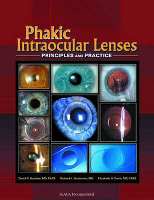 Phakic Intraocular Lenses - David R. Hardten, Richard L. Lindstrom, Elizabeth A. Davis