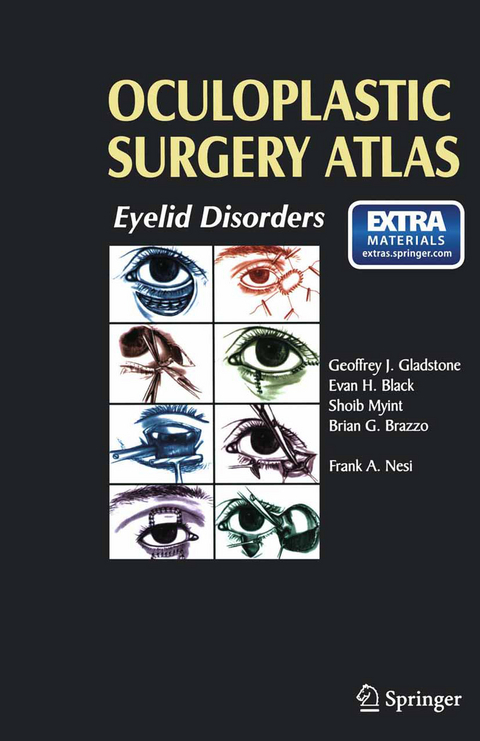 Oculoplastic Surgery Atlas - 