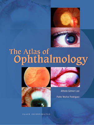 The Atlas of Ophthalmology - Alfredo Gomez Leal, Pablo Munoz Rodriguez