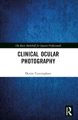 Clinical Ocular Photography - Denise Cunningham