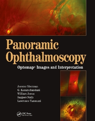 Panoramic Ophthalmoscopy - Jerry Sherman, Gulshan Karamchandani, William Jones, Sanjeev Nath