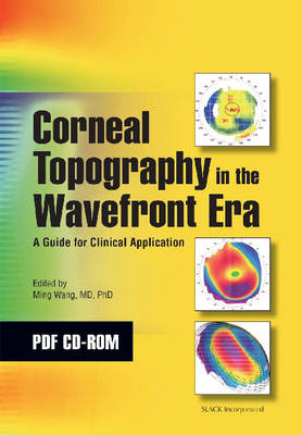 Corneal Topography - Ming Wang