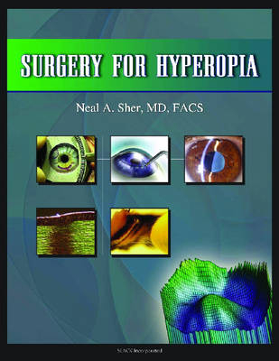 Surgery for Hyperopia - Neal Sher