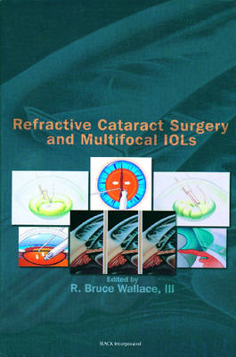 Refractive Cataract Surgery and Multifocal IOLs - R. Bruce Wallace III.