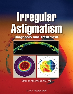 Irregular Astigmatism - Ming Wang