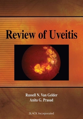 Review of Uveitis - Russell N. Van Gelder, Anita Prasad