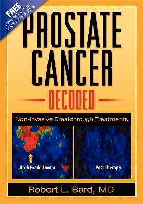 Prostate Cancer Decoded - Robert L Bard