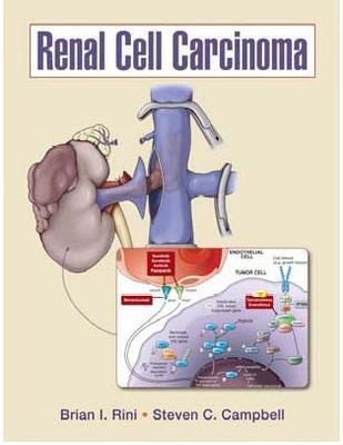 Renal Cell Carcinoma - Brian Rini, Steven Campbell