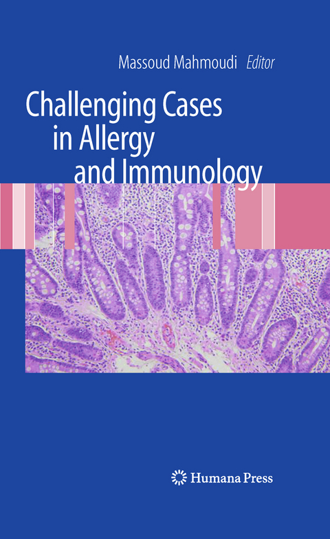 Challenging Cases in Allergy and Immunology - 