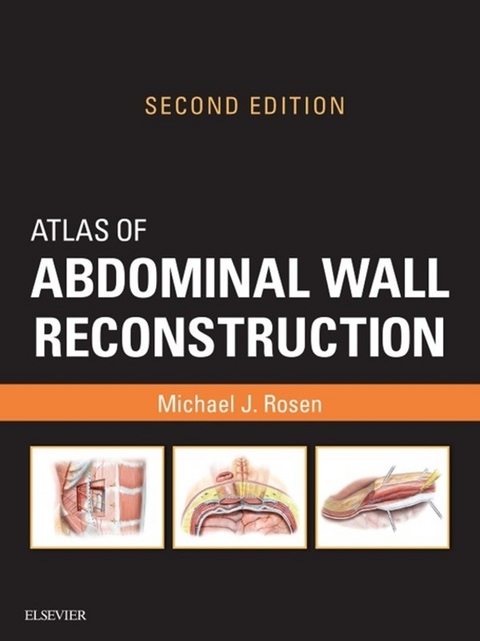 Atlas of Abdominal Wall Reconstruction E-Book -  Michael J. Rosen