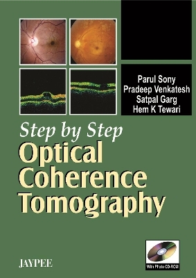 Step by Step: Optical Coherence Tomography - Parul Sony, Pradeep Venkatesh, Satpal Garg, Hem K Tewari