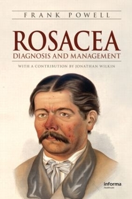 Rosacea - Frank Powell