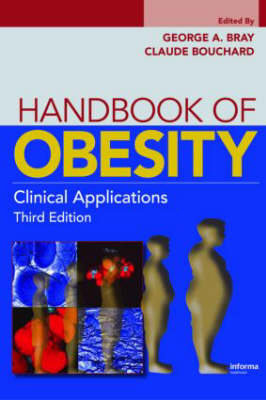 Handbook of Obesity - 