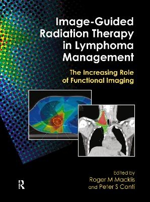 Image-Guided Radiation Therapy in Lymphoma Management - 