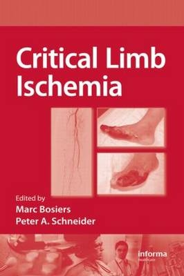 Critical Limb Ischemia - 