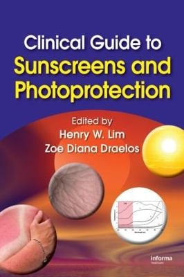 Clinical Guide to Sunscreens and Photoprotection - 