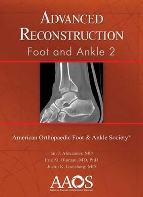 Advanced Reconstruction: Foot and Ankle 2 - 