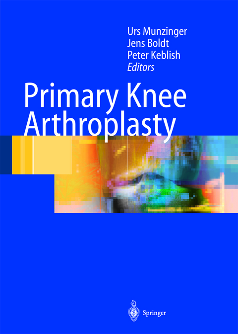 Primary Knee Arthroplasty - 