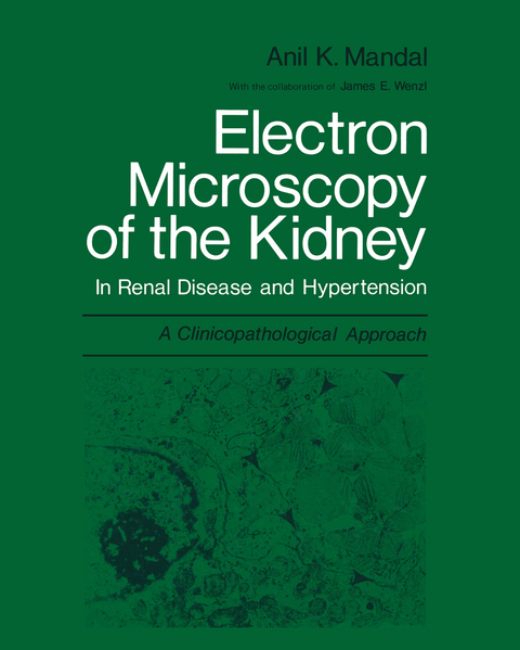 Electron Microscopy of the Kidney - Anil K. Mandal