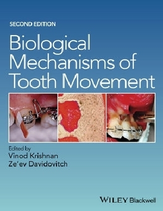 Biological Mechanisms of Tooth Movement - 