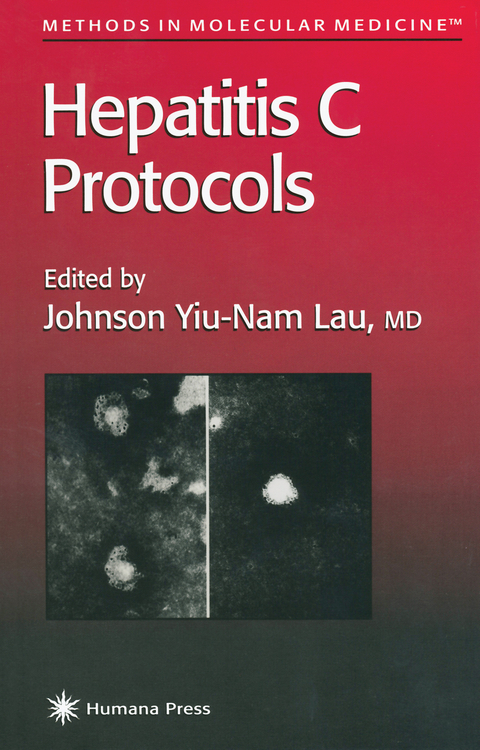 Hepatitis C Protocols - 