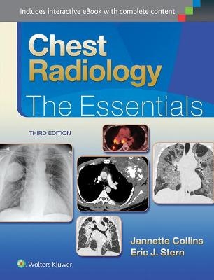 Chest Radiology: The Essentials - Janette Collins, Eric J. Stern