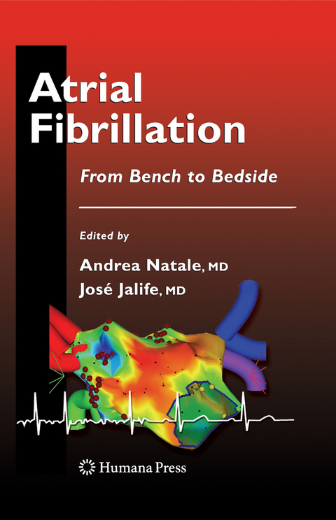 Atrial Fibrillation - 