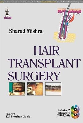 Hair Transplant Surgery - Sharad Mishra