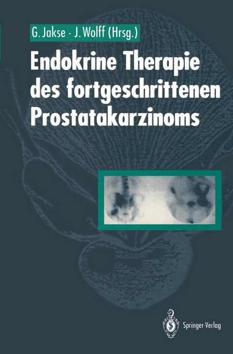 Endokrine Therapie des fortgeschrittenen Prostatakarzinoms - 