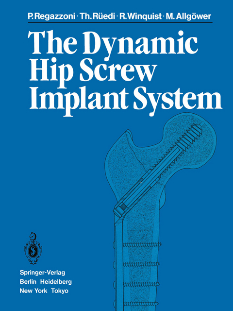 The Dynamic Hip Screw Implant System - P. Regazzoni, T. Rüedi, R. Winquist, M. Allgöwer