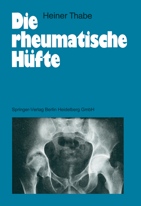 Die rheumatische Hüfte - Heiner Thabe