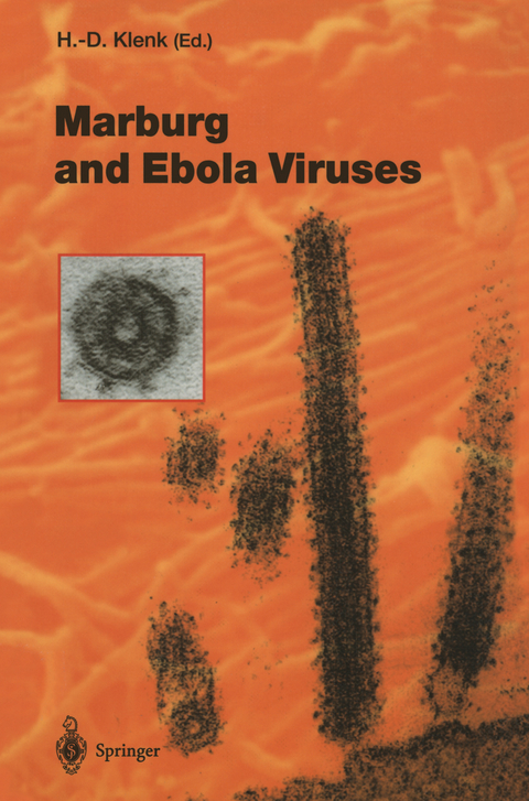 Marburg and Ebola Viruses - 